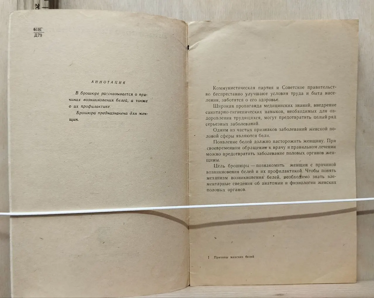 Причины женских белей фото 3